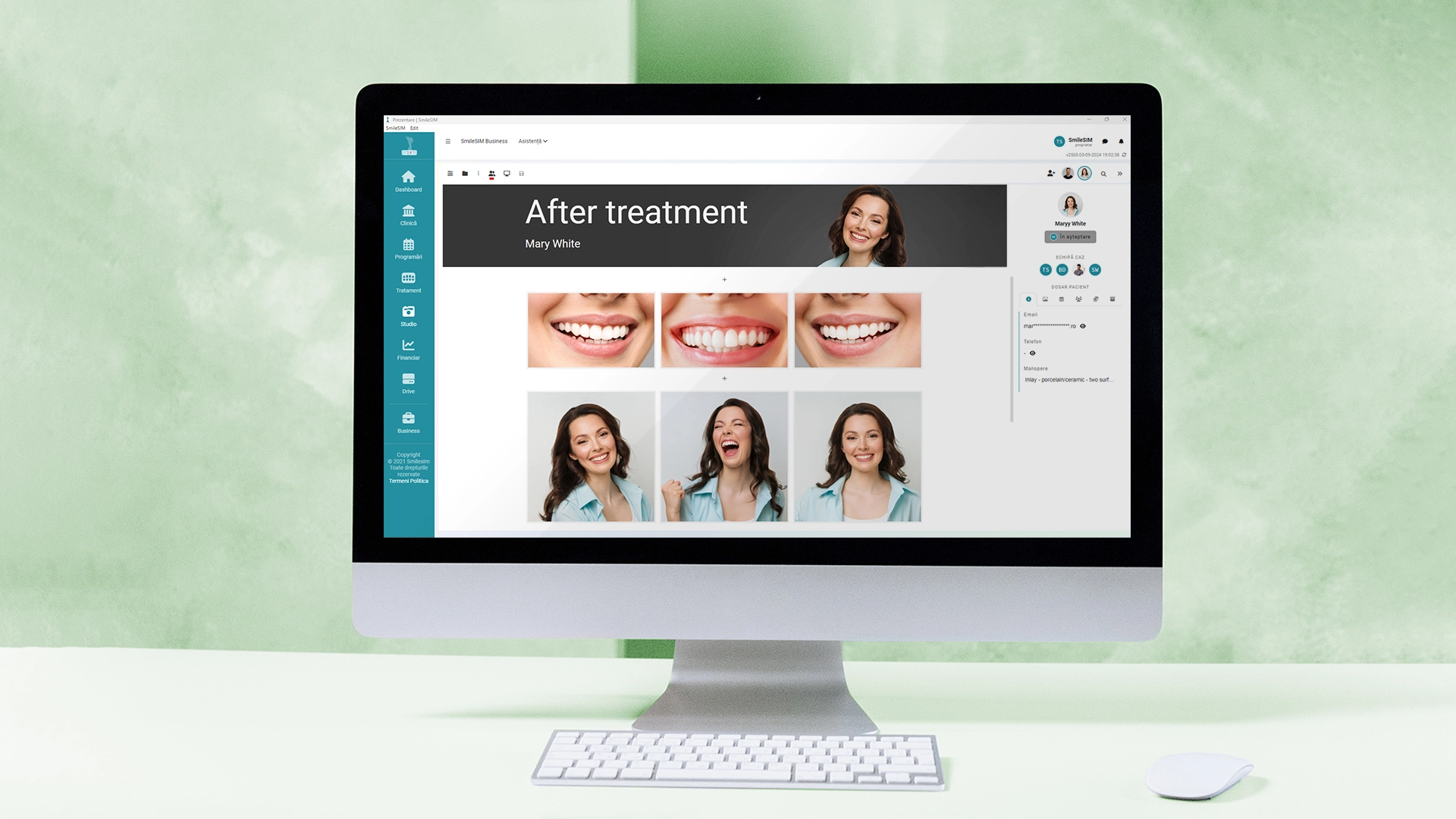 Previzualizarea caracteristiciilor aplicației software al modulului Studio